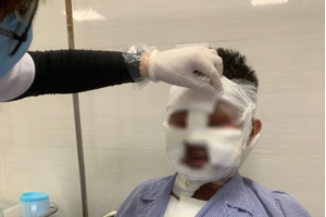 Nam thanh niên bị bỏng nặng vì bình ga mini phát nổ