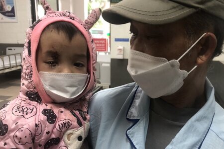Tuyên Quang: Bé gái 3 tuổi bị lợn cắn vào mắt đứt lệ quản