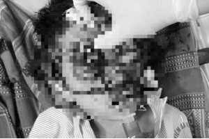 Nghịch súng kíp, bé trai 6 tuổi bị đạn bắn vào đầu