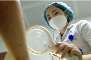 Kiêng tắm quá lâu nhiều F0 bị viêm da, mẩn ngứa