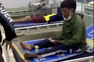 Đi khai thác keo, 4 người bị sét đánh phải nhập viện cấp cứu