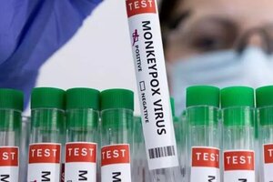 Việt Nam làm gì để ứng phó với bệnh đậu mùa khỉ đang lây lan trên thế giới?