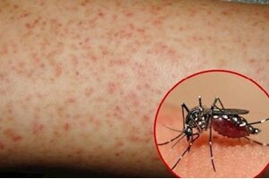 TP.HCM: Hai huyện có số ca bệnh sốt xuất huyết tăng báo động