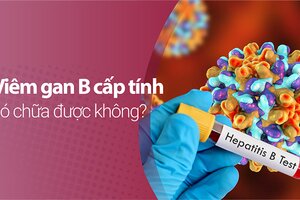 Viêm gan B cấp tính có chữa được không, điều trị thế nào?