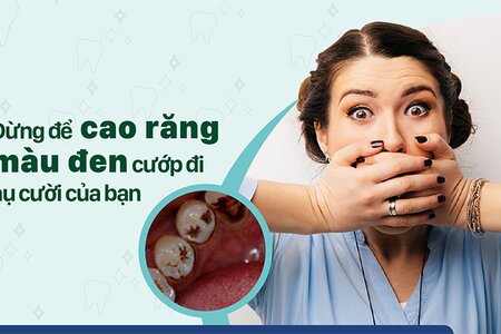 Đừng để cao răng màu đen "cướp" đi nụ cười của bạn!