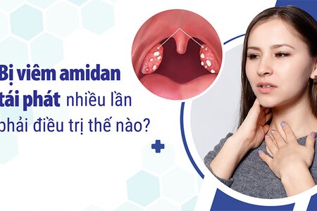 Bị viêm amidan tái phát nhiều lần phải điều trị thế nào?