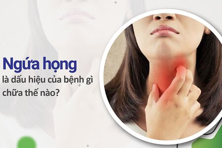 Ngứa họng là dấu hiệu của bệnh gì, chữa thế nào hiệu quả?