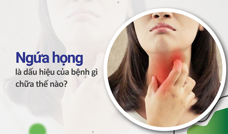 Ngứa họng là dấu hiệu của bệnh gì