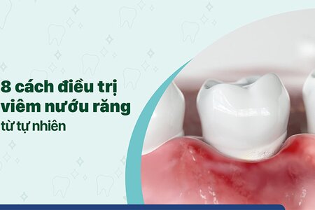 Tiết lộ ngay 8 cách điều trị viêm nướu răng từ tự nhiên