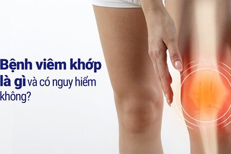 Bệnh viêm khớp là gì và có nguy hiểm không?