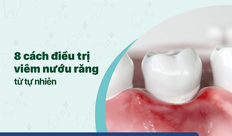 Bệnh viêm nướu răng