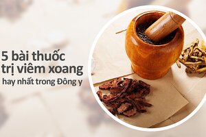 5 bài thuốc trị viêm xoang hay nhất trong Đông y