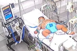 Cảnh giác với sốc sốt xuất huyết Dengue nặng ở trẻ béo phì