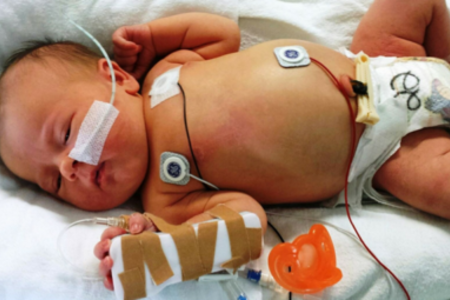 Trẻ sơ sinh bị viêm màng não do mẹ bầu không sàng lọc liên cầu B