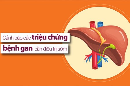 Cảnh báo các triệu chứng bệnh gan cần điều trị sớm