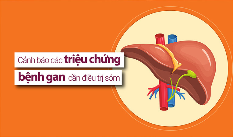 triệu chứng bệnh gan