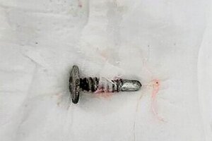 Bé trai 3 tuổi tử vong vì nuốt phải đinh vít ở trường mầm non