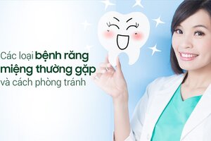 Các loại bệnh răng miệng thường gặp và cách phòng tránh
