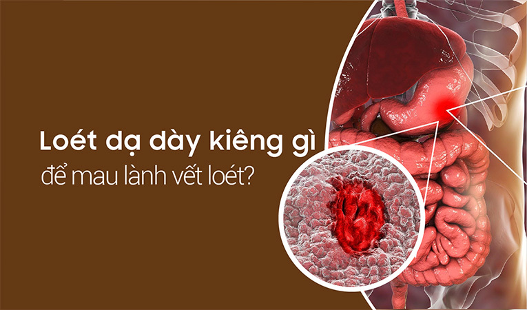 Loét dạ dày kiêng gì