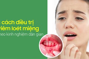 Mách nhỏ 3 cách điều trị viêm loét miệng theo kinh nghiệm dân gian