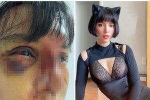 Quá khứ bất hạnh của siêu mẫu Khả Trang trước khi bị đánh đập thâm tím mặt mày