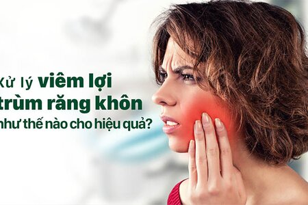 Xử lý khi bị viêm lợi trùm như thế nào cho hiệu quả?