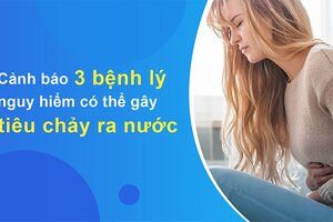 Cảnh báo 3 bệnh lý nguy hiểm có thể gây tiêu chảy ra nước!