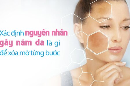 Xác định nguyên nhân gây nám da là gì để xóa mờ từng bước