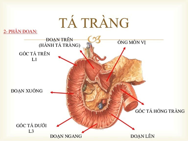 viêm hành tá tràng