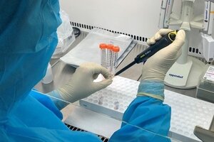 Vì sao Bắc Giang không mua kit xét nghiệm của Công ty Việt Á?