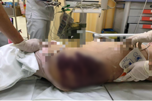 Người phụ nữ bạo hành con riêng 8 tuổi của người tình đến tử vong khai gì?