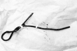 Bắt chước phim ảnh, bé trai nhét thanh sắt hơn nửa mét vào hậu môn