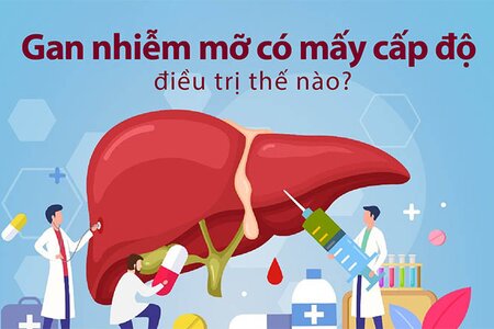 Gan nhiễm mỡ có mấy cấp độ, điều trị thế nào?