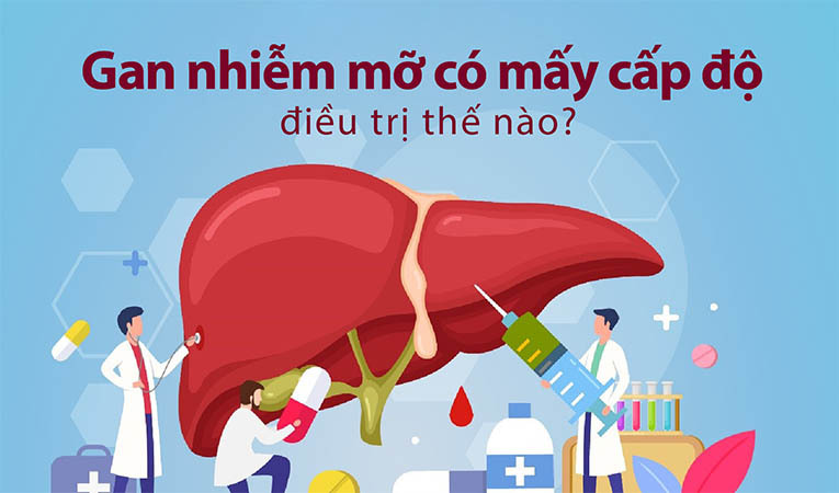 Gan nhiễm mỡ có mấy cấp độ