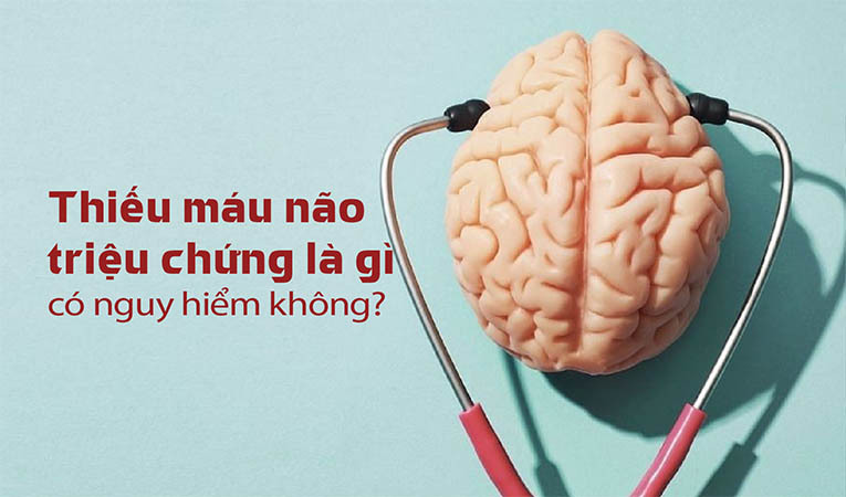 Thiếu máu não triệu chứng 