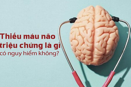 Thiếu máu não triệu chứng là gì? Khi nào nguy hiểm?