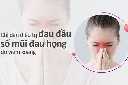 Chỉ dẫn điều trị đau đầu sổ mũi đau họng do viêm xoang