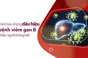 Cảnh báo những dấu hiệu bệnh viêm gan B nhiều người không biết!