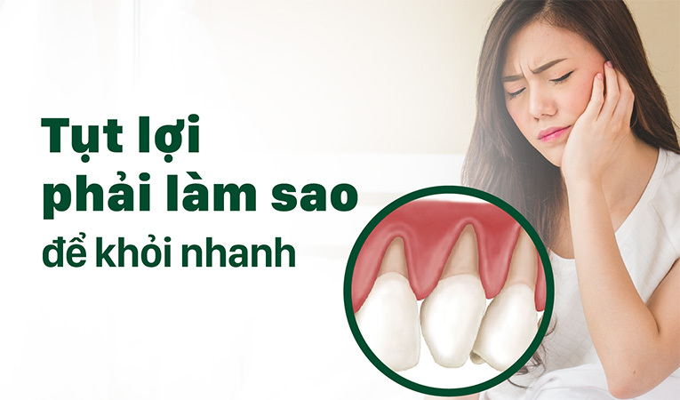 Tụt lợi phải làm sao