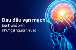 Đau đầu vận mạch – bệnh phổ biến nhưng ít người hiểu rõ