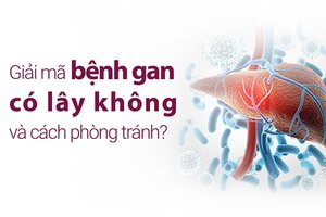 Giải mã bệnh gan có lây không và cách phòng tránh