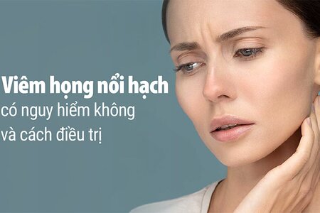 Tìm hiểu viêm họng nổi hạch có nguy hiểm không và cách điều trị