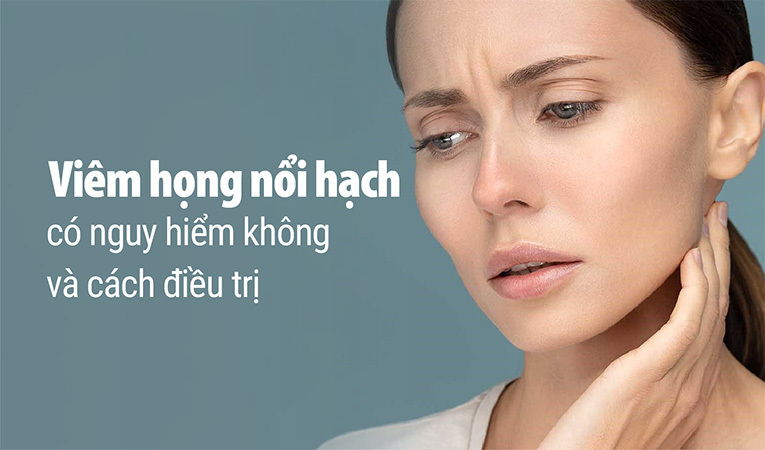 Viêm họng nổi hạch