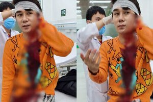 Khởi tố vụ diễn viên phim 'Thương ngày nắng về' bị chém 