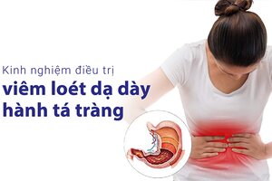 Kinh nghiệm điều trị viêm loét dạ dày hành tá tràng