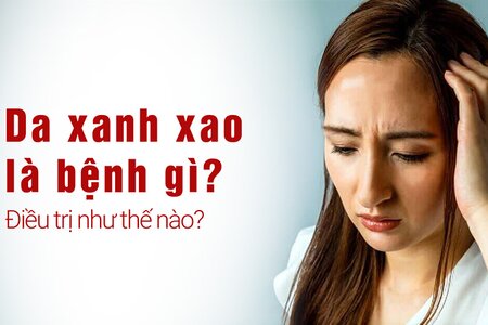 Da xanh xao là bệnh gì? Điều trị như thế nào?