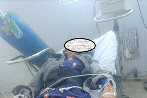 Bị ép 'tiếp khách' cô gái nhảy từ tầng 5 quán karaoke xuống đất