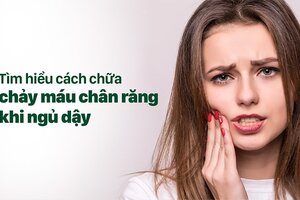 Tìm hiểu cách chữa chảy máu chân răng khi ngủ dậy