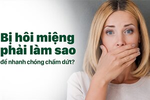Bị hôi miệng phải làm sao để nhanh chóng chấm dứt?