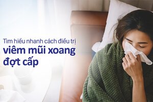 Tìm hiểu nhanh cách điều trị viêm mũi xoang đợt cấp